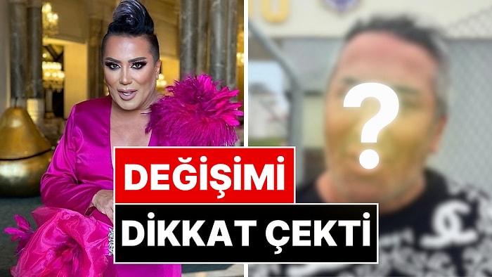 102 Gün Sonra Cezaevinden Tahliye Olan Murat Övüç'ün Son Hali Dikkat Çekti!