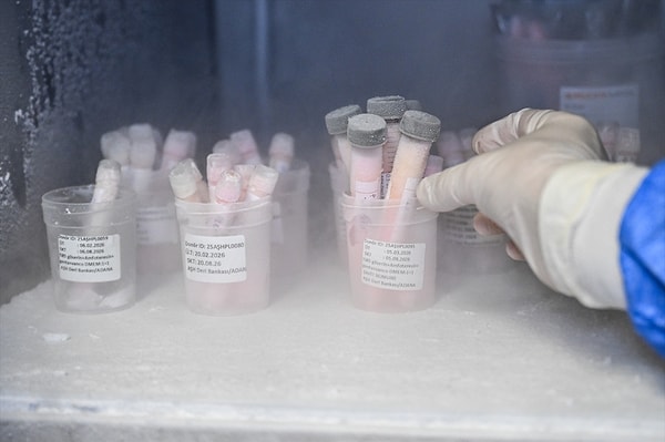 Sağlık Bakanlığı öncülüğünde geçen yıl kurulan Türkiye'nin ilk ve tek deri bankası ve doku laboratuvarı, ağır yanık nedeniyle tedavi gören hastaların sağlıklarına kavuşmalarına katkı sağlıyor.