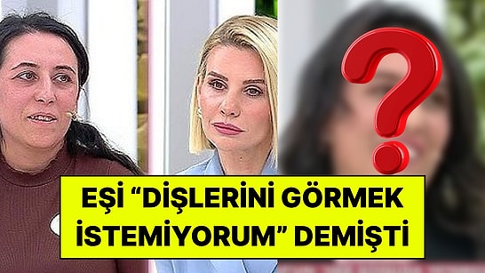 Esra Erol’da Programında Eşi Dişlerini Eleştirmişti: Derya Son Haliyle Programa Katıldı!