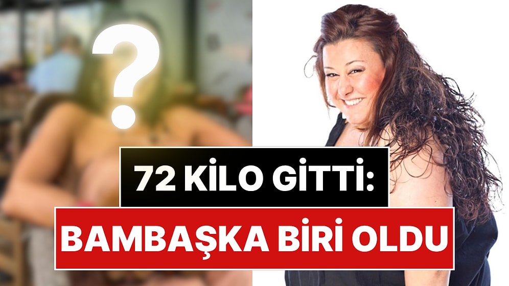 72 Kilo Birden Veren Oyuncu Esin Gündoğdu’nun Son Hali Yeniden Gündem Oldu