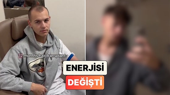 İstanbul'da Saç Ekimi Yaptıran Yabancı İçerik Üreticisi Yaşadığı Değişimi Paylaştı
