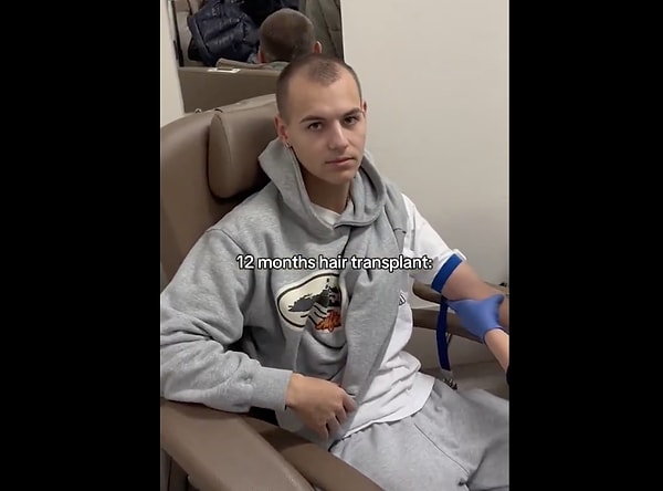 So, is there really an age limit for hair transplantation?