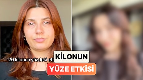 20 Kilo Veren Bir Kadın Yüzünde Meydana Gelen Değişimi Paylaştı