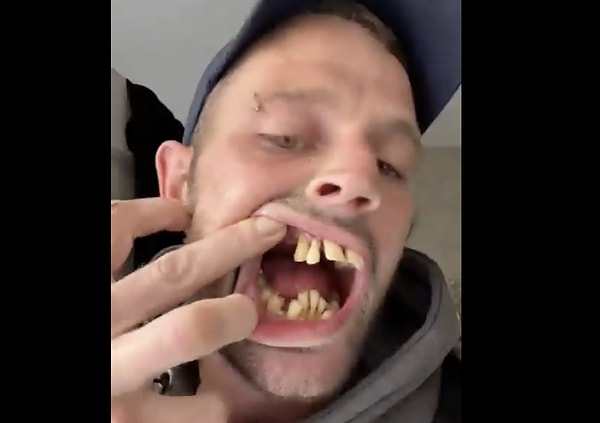 Peki Türkiye diş turizminde neden bu kadar öne çıkıyor?