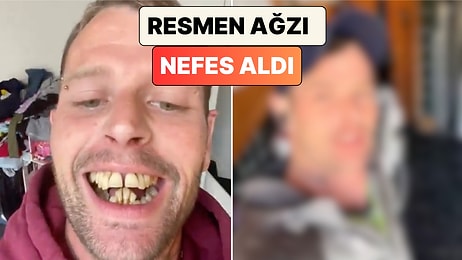 Dişlerini Yaptırmak İçin Türkiye'ye Gelen Turist İnanılmaz Değişimini Paylaştı