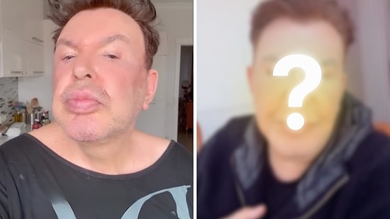 Kuşum Aydın Reveals Post-Surgery Look