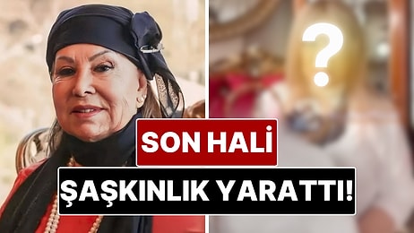 Dört Yıl Önce Yüzünü Gerdiren 85 Yaşındaki Bedia Akartürk’ün Son Hali Görenleri Şaşırttı!