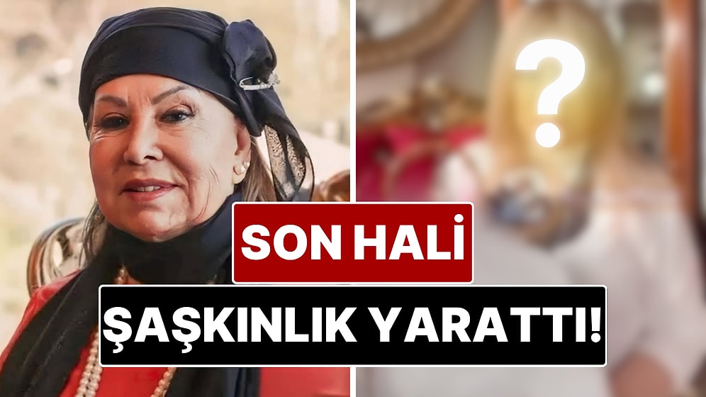 Dört Yıl Önce Yüzünü Gerdiren 85 Yaşındaki Bedia Akartürk’ün Son Hali Görenleri Şaşırttı!