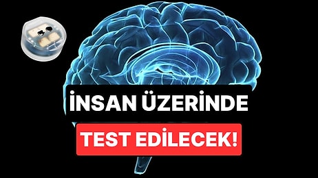 Depresyon Geçiren Beyin İmplantı İnsan Üzerinde Test Edilmeye Hazırlanıyor