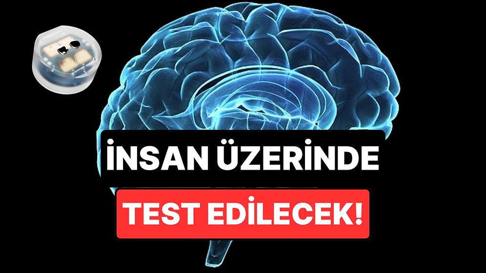 Depresyon Geçiren Beyin İmplantı İnsan Üzerinde Test Edilmeye Hazırlanıyor
