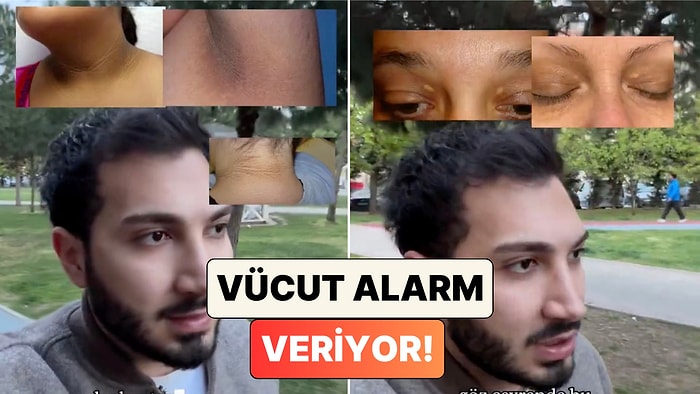 Görmezden Gelmeyin! Doktor Mehmet Ali Tatar Vücudumuzdaki Bazı Belirtilerin Ne Anlama Geldiğini Anlattı