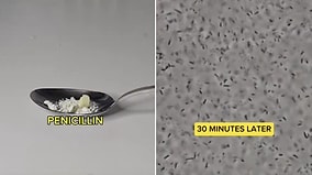 Impact of Antibiotics Against Bacteria Examined Under the Microscope