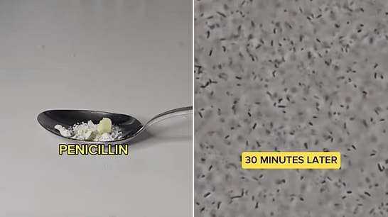 Impact of Antibiotics Against Bacteria Examined Under the Microscope