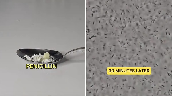 Impact of Antibiotics Against Bacteria Examined Under the Microscope