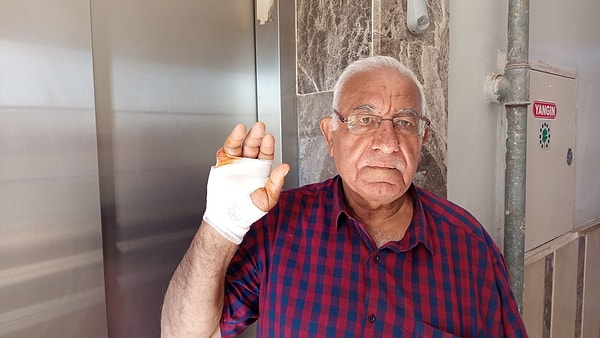 His neighbor bit off his finger!