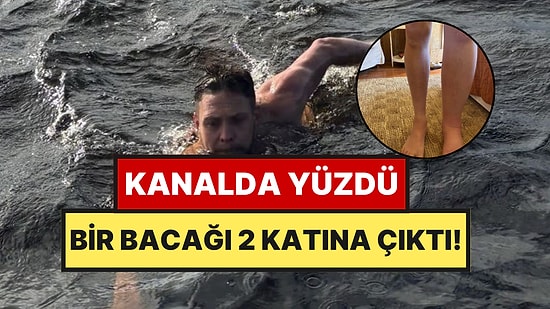 Kanalda Yüzme Keyfi Kabusa Döndü: Bir Bacağı Diğerinin İki Katı