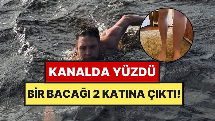 Kanalda Yüzme Keyfi Kabusa Döndü: Bir Bacağı Diğerinin İki Katı