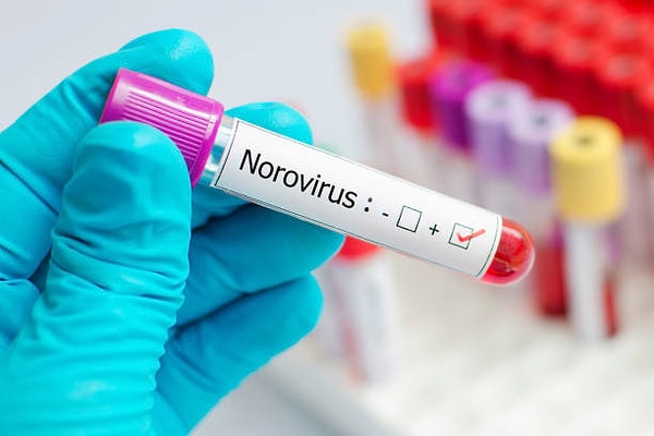 Norovirüs Nedir?