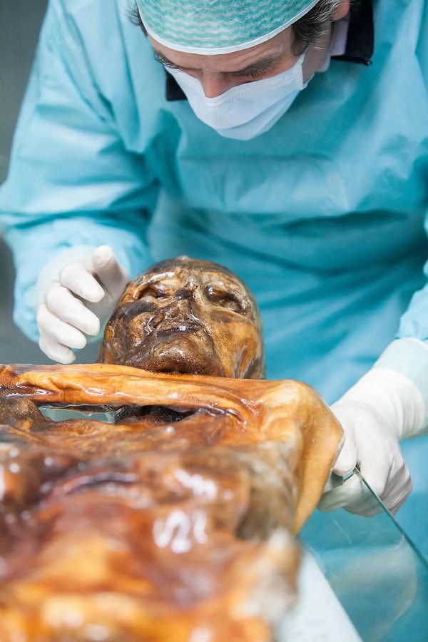 For the first time, the most detailed map of 'Ice Man Ötzi' has been unveiled.