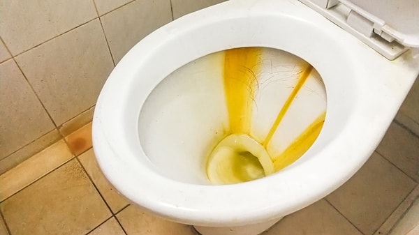 Sitrik Asitle Klozet Temizliği Nasıl Yapılır?