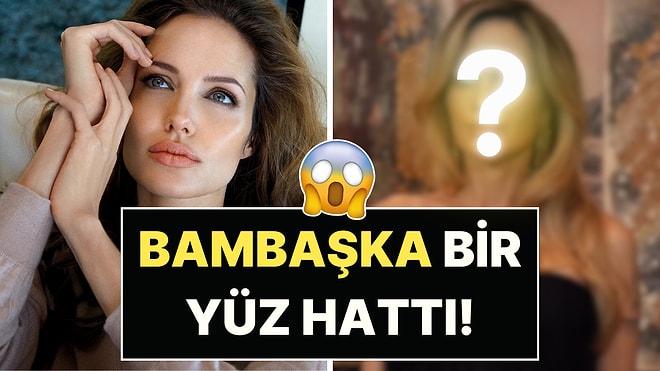 Yüzüne Yeni İşlemler Yaptıran Angelina Jolie'nin Son Halini Görenler Tanımakta Zorlandı!
