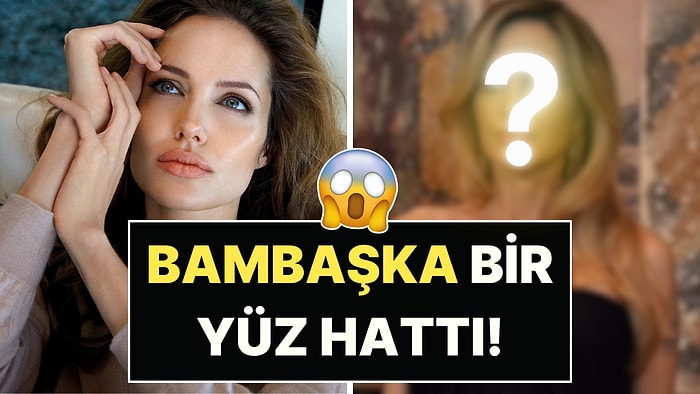 Yüzüne Yeni İşlemler Yaptıran Angelina Jolie'nin Son Halini Görenler Tanımakta Zorlandı!
