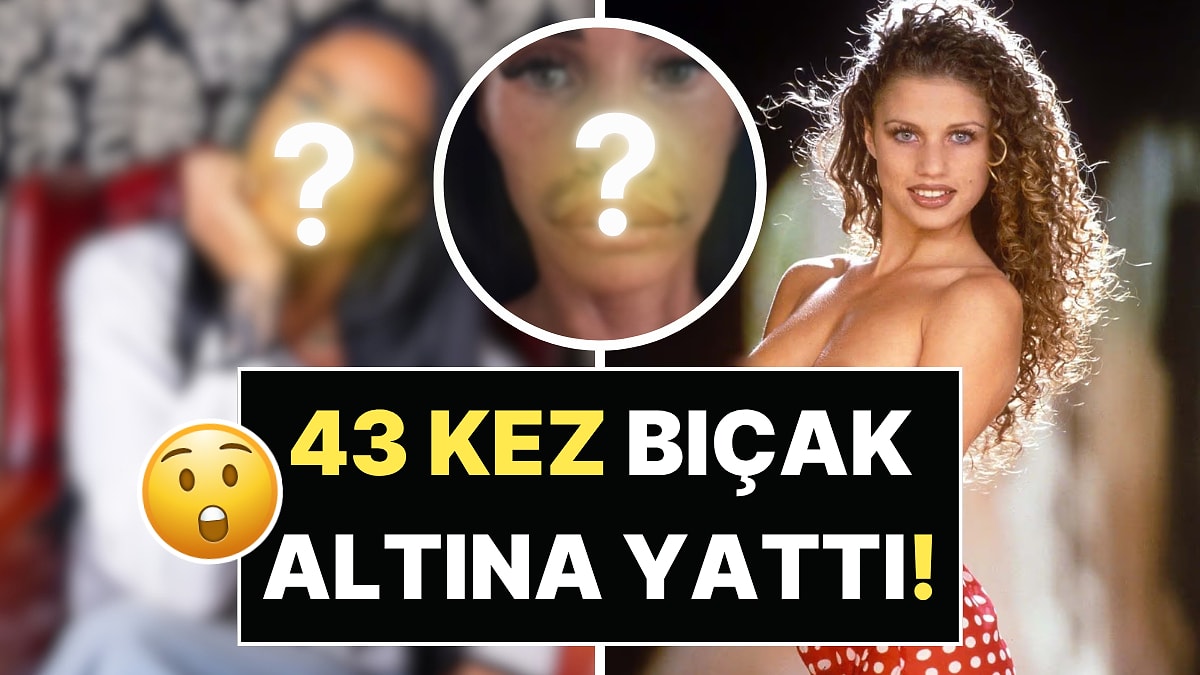 Bir Dönemin Meşhur Üstsüz Modeli Katie Price 43 Estetikten Sonra Tanınmaz Hale Geldi!