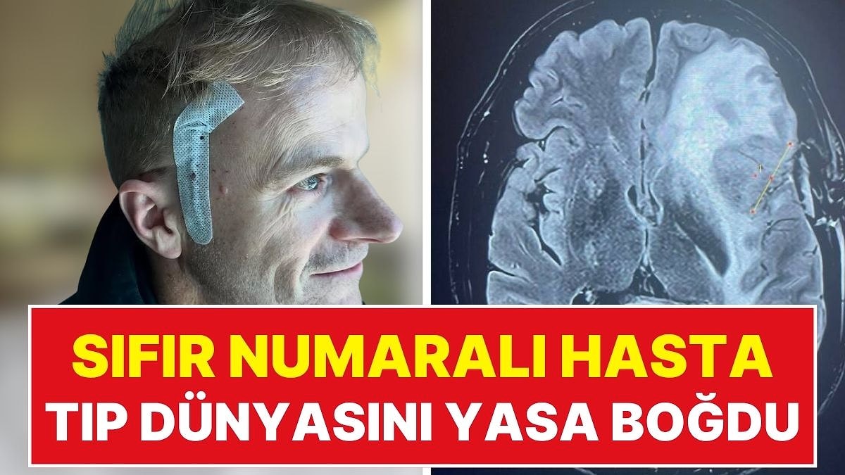 Kendi Üzerinde Denediği Tedaviyle Tıp Tarihine Geçmişti: Ünlü Bilim İnsanı Richard Scolyer Hayatını Kaybetti