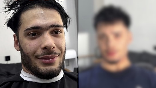 Surgery Without a Scalpel: Hairdresser Shares Mind-Blowing Transformation