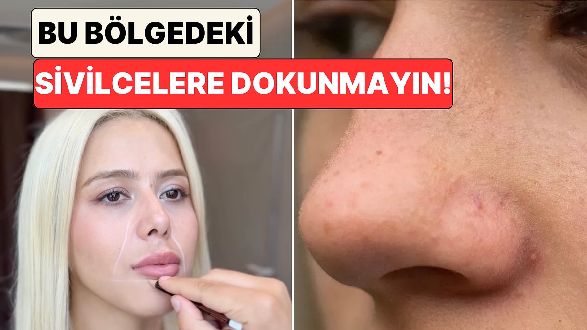 Felce Bile Sebep Olabilir! Bir Doktor Yüzde Asla Dokunulmaması Gereken "Ölüm Üçgenini" Gösterdi