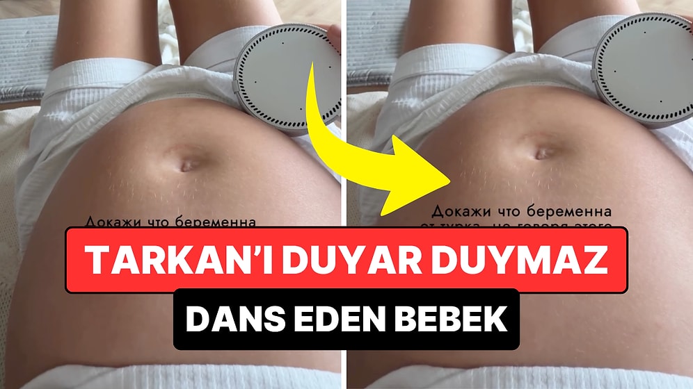 Rus Kadının Tarkan'lı 'DNA Testi' Viral Oldu: Bebek Duyar Duymaz Dans Etti
