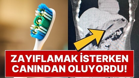 Zayıflamak İsterken Kabusu Yaşadı: İstanbul’da 21 Yaşındaki Kız 13 cm’lik Diş Fırçasını Yuttu