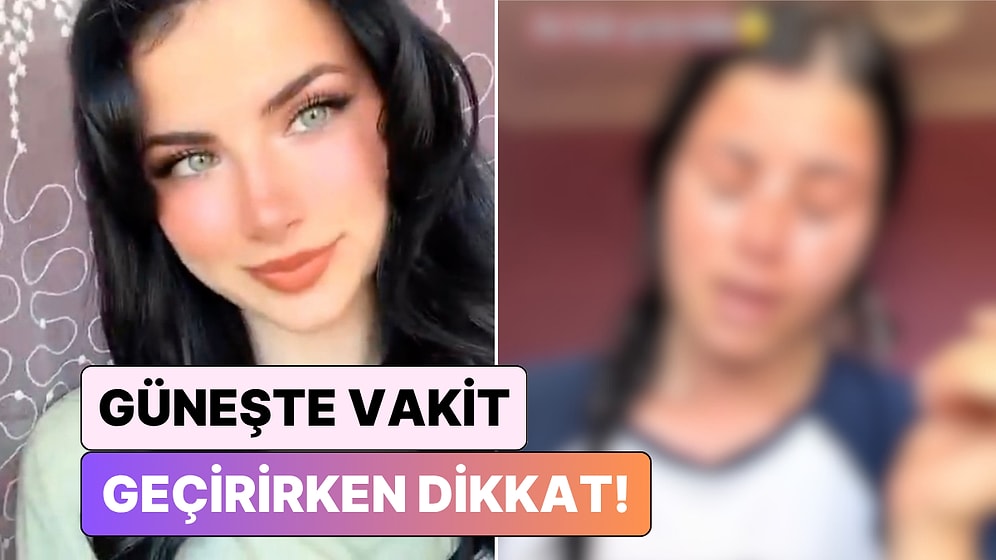 Önlem Almadan Çıkmayın! Güneş Altında Uyuyakalan Genç Kızın Yüzünde 2. Dereceden Yanık Oluştu