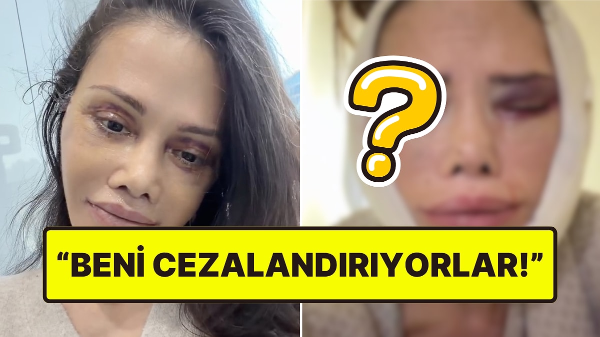 Kore'de Yüz Nakli Yaptıran Didem Ceran, Revizyon Ameliyatı Olduğunu Açıkladı