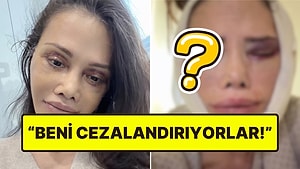 Kore'de Yüz Nakli Yaptıran Didem Ceran, Revizyon Ameliyatı Olduğunu Açıkladı