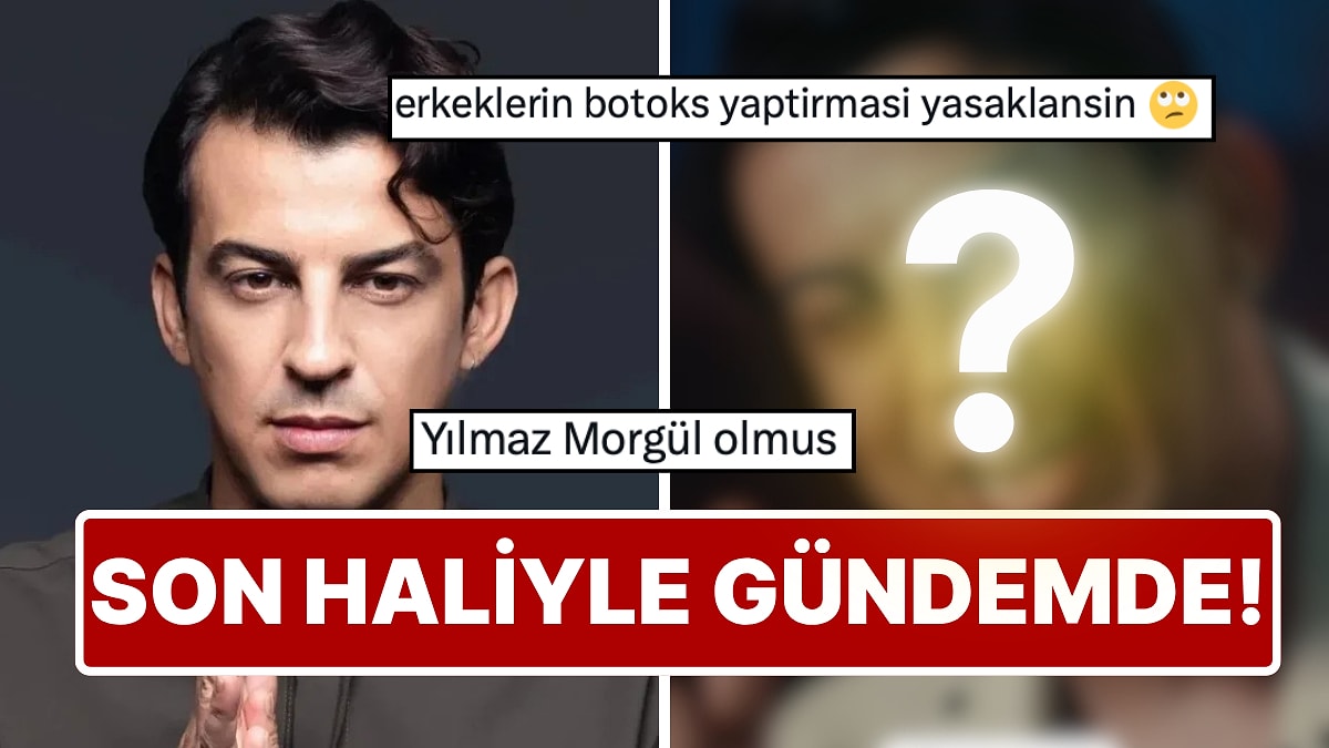 Norm Ender'in son hali botoks iddialarını alevlendirdi