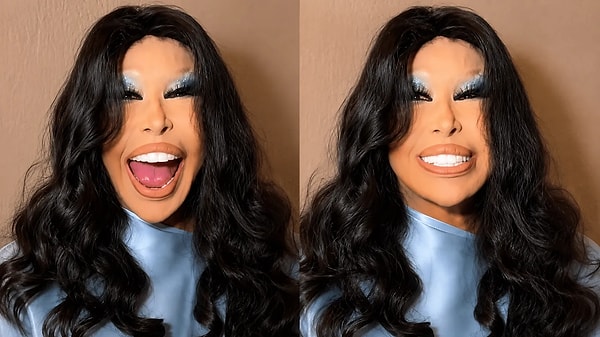 Bülent Ersoy'un yıllar içinde gündemden düşmemesinin bir diğer nedeni ise görünümüne gösterdiği özen ve tercih ettiği estetik dokunuşlar oldu.