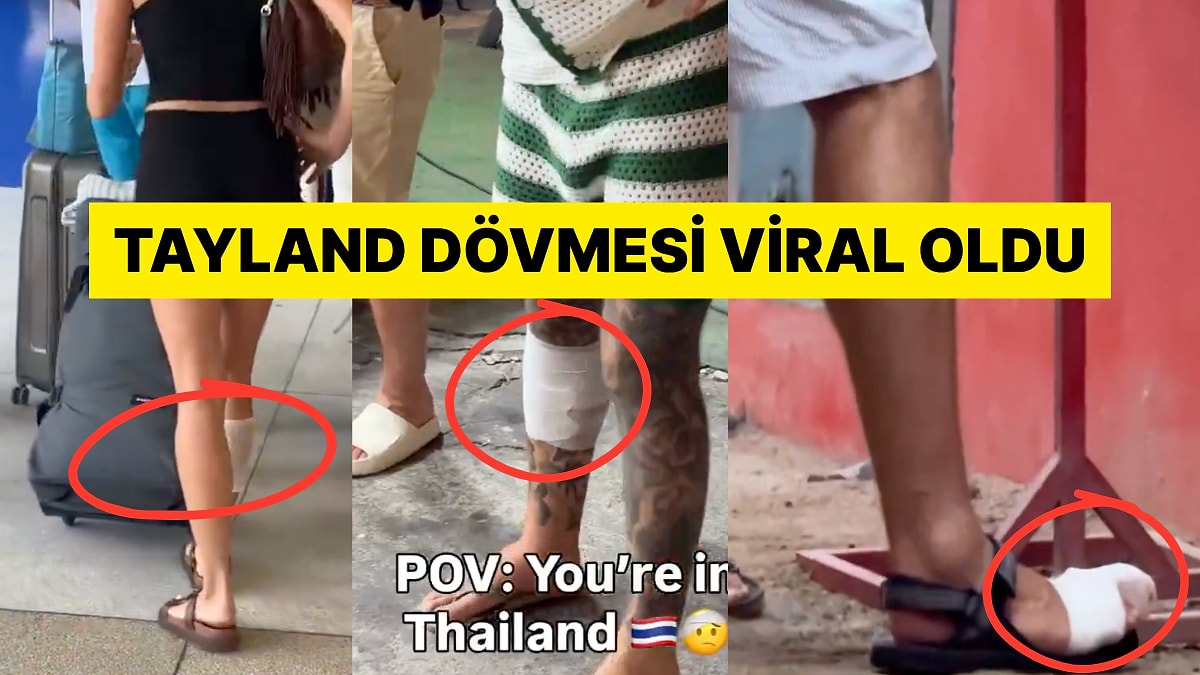 Tayland'a Giden Turistlerin Bacaklarında Çıkan Yanıkların Sebebi Ne?