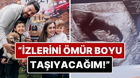 12 Haftalık Bebeğini Kaybeden Berfu Yenenler'den Yürek Burkan Açıklama