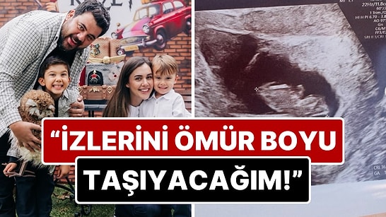 12 Haftalık Bebeğini Kaybeden Berfu Yenenler'den Yürek Burkan Açıklama
