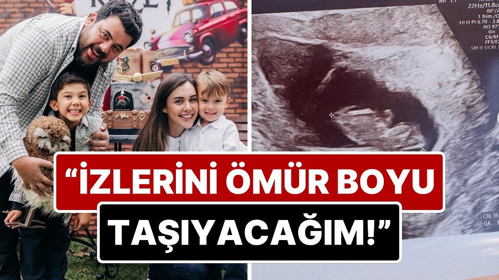12 Haftalık Bebeğini Kaybeden Berfu Yenenler'den Yürek Burkan Açıklama