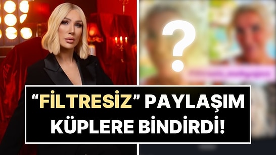 Seda Sayan "Filtresiz Hali" Diye Paylaşılan Fotoğrafı Görünce Küplere Bindi!
