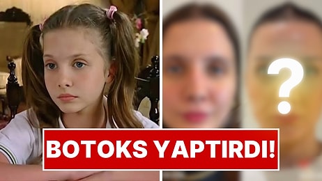 Selena’nın Küçük Nazlı’sıydı: Dilara Kurtulmuş Botoks Sonrası Değişimiyle Gündemde!