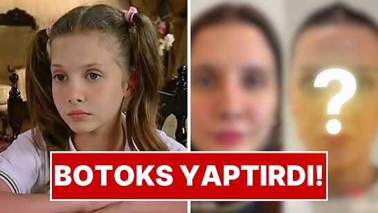 Selena’nın Küçük Nazlı’sıydı: Dilara Kurtulmuş Botoks Sonrası Değişimiyle Gündemde!