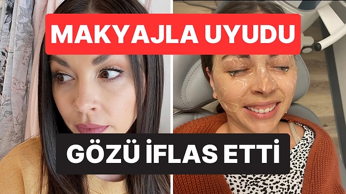 20 Yıl Boyunca Göz Makyajıyla Uyudu, Tedavisi Olmayan Göz Hastalığına Yakalandı