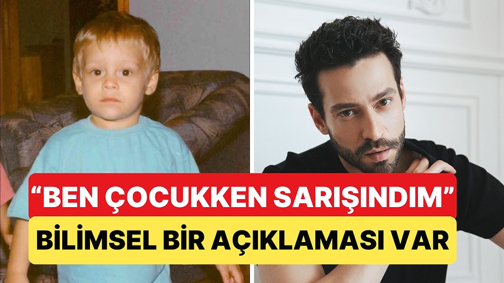 "Ben Çocukken Sarışınmışım" Diyenlerin Saçları Büyüdükçe Neden Koyulaşıyor?