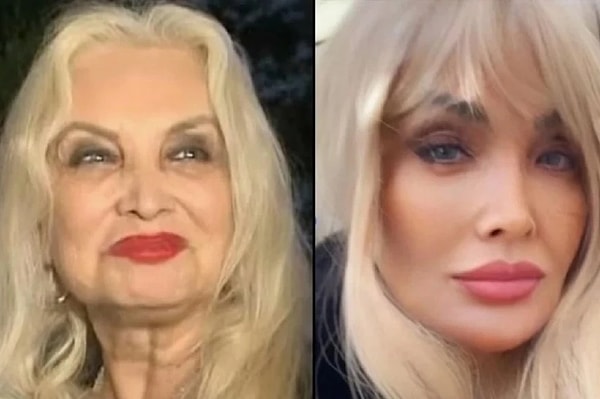 Sosyal medyayı aktif kullanan Sevim Emre, son yıllarda paylaşımlarına uyguladığı öne sürülen filtrelerle de sık sık magazin gündeminin merkezinde yer aldı.