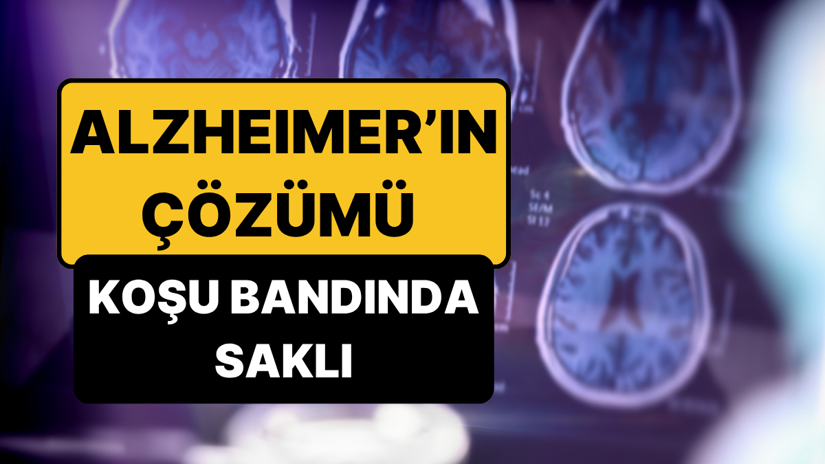Bilime Göre Koşu Bandında Koşmak Alzheimer Hastalığına Bir Çözüm Olabilir!