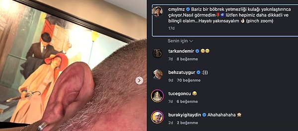 Cem Yılmaz'dan "Kulak çizgisi kalp krizi habercisi" goygoyu.