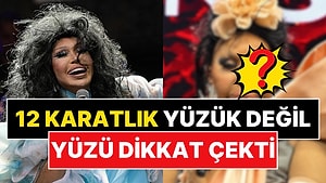 Lolita Estetiğiyle Yüzünü Gerdirmişti: Bülent Ersoy'un Son Hali Ortaya Çıktı!